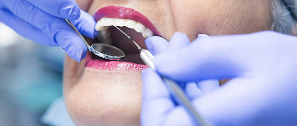 Best Same-Day Emergency Dental Services in Mercer Island, WA
